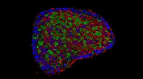 Ontwikkeling minilong brengt oplossing ongeneeslijke longziekte COPD dichterbij